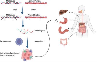 Advances in immunotyping of colorectal cancer